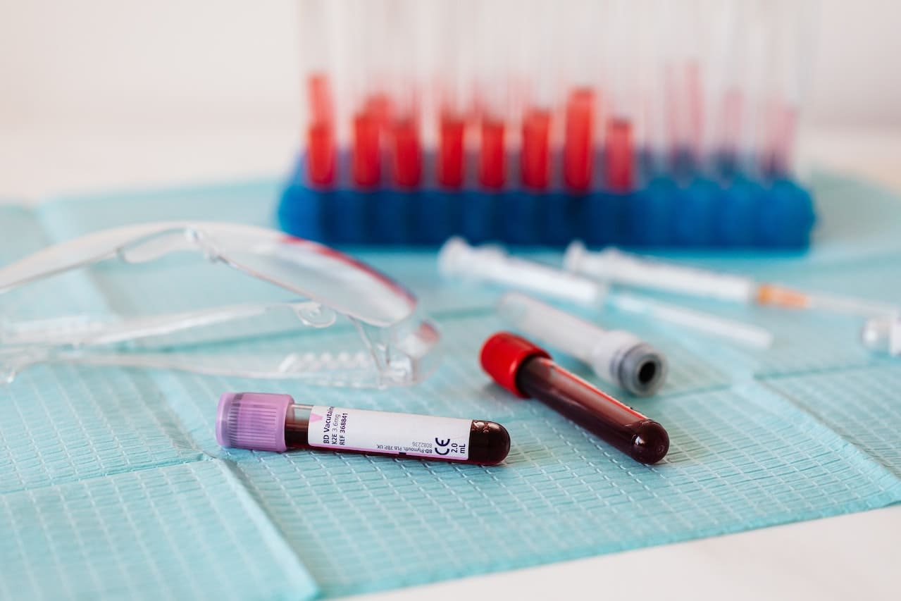 transaminases élevées quand s'inquiéter