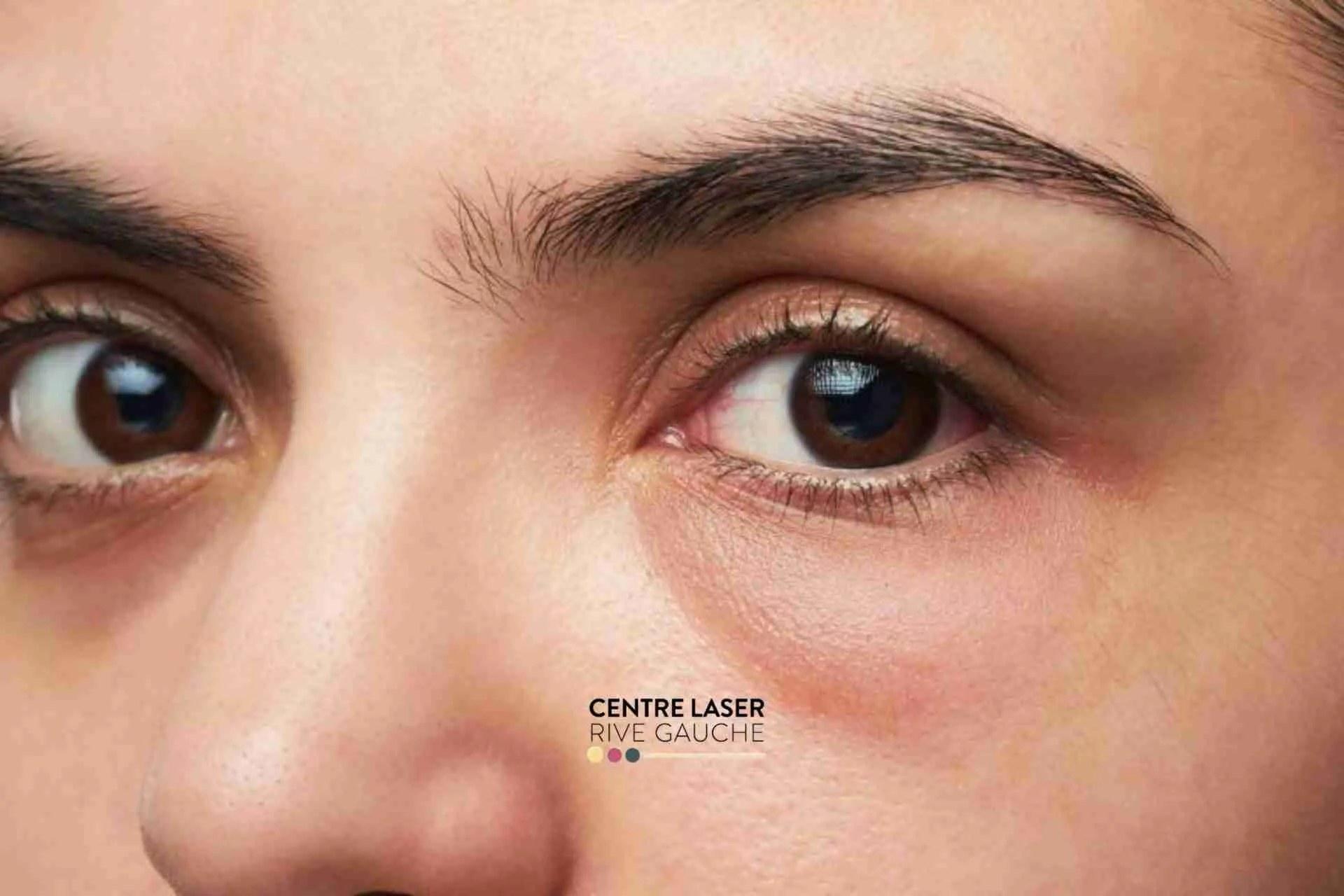 Femme appliquant un soin contour des yeux pour atténuer les cernes